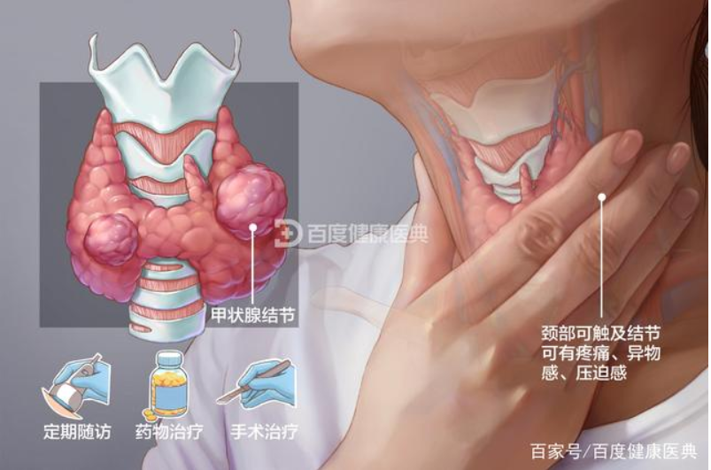 市婦保院成功開展首例單側甲狀腺腺葉切除術,診治水平邁上新臺階 - 掌